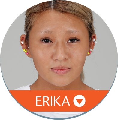 ERIKA