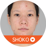 SHOKO